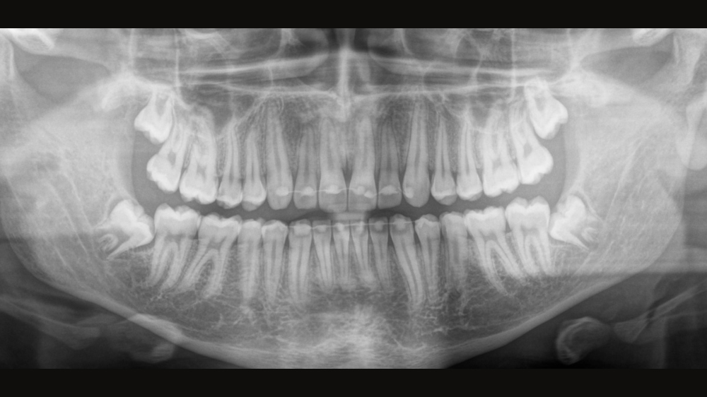 適応症に基づく低線量でのCT撮影は、さまざまな臨床状況に適しています