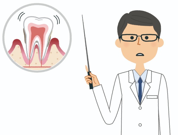 歯周病治療